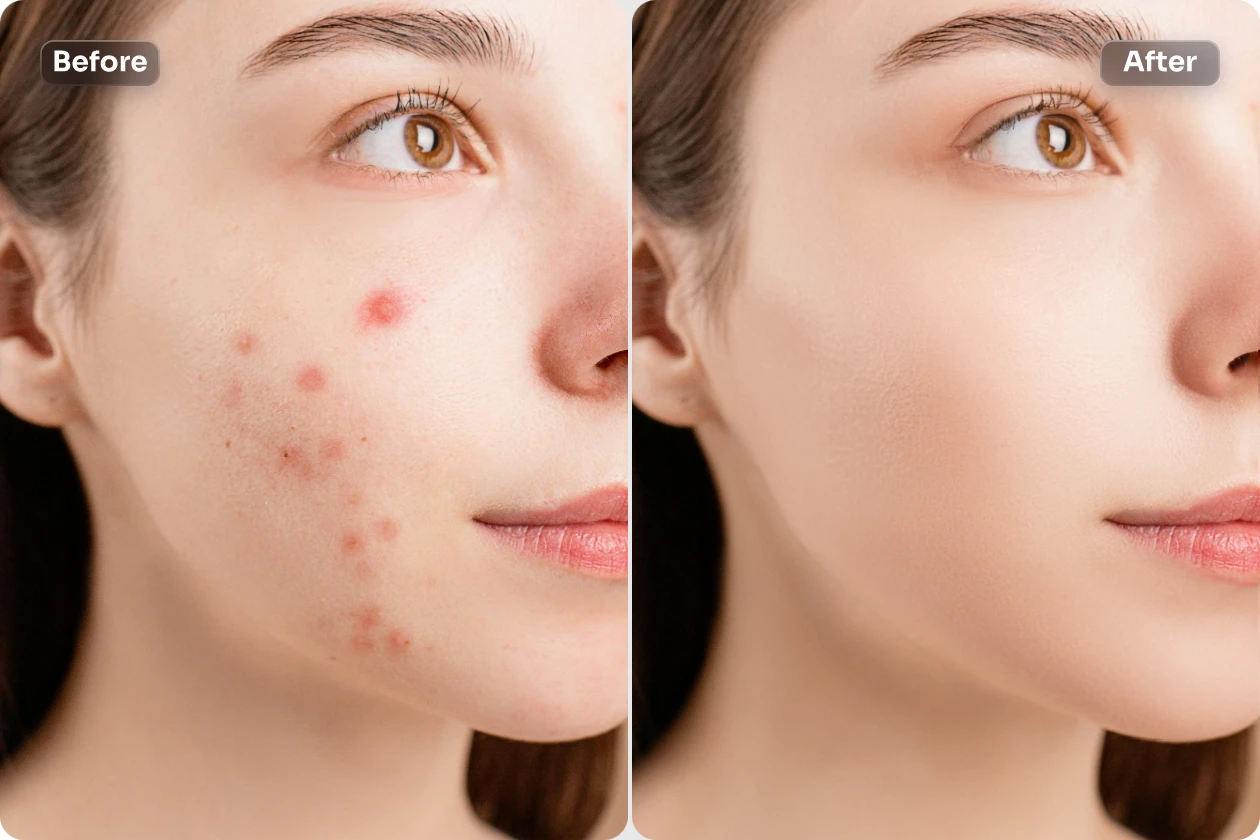 supprimer les taches sur le visage d'une femme à l'aide de l'outil de retouche photo en ligne gratuit AI Ease
