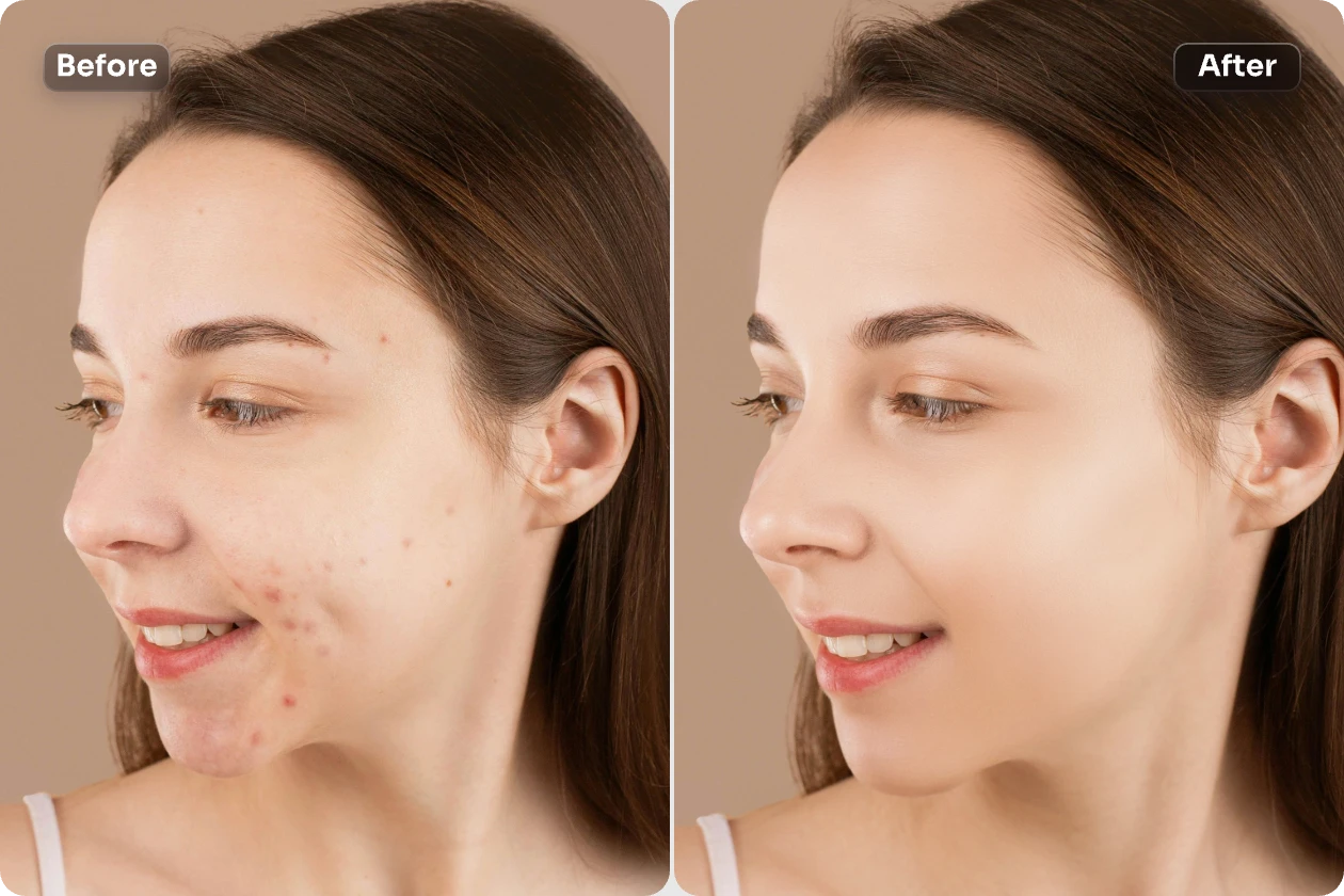使用 aiease face editor 去除女性臉上的粉刺
