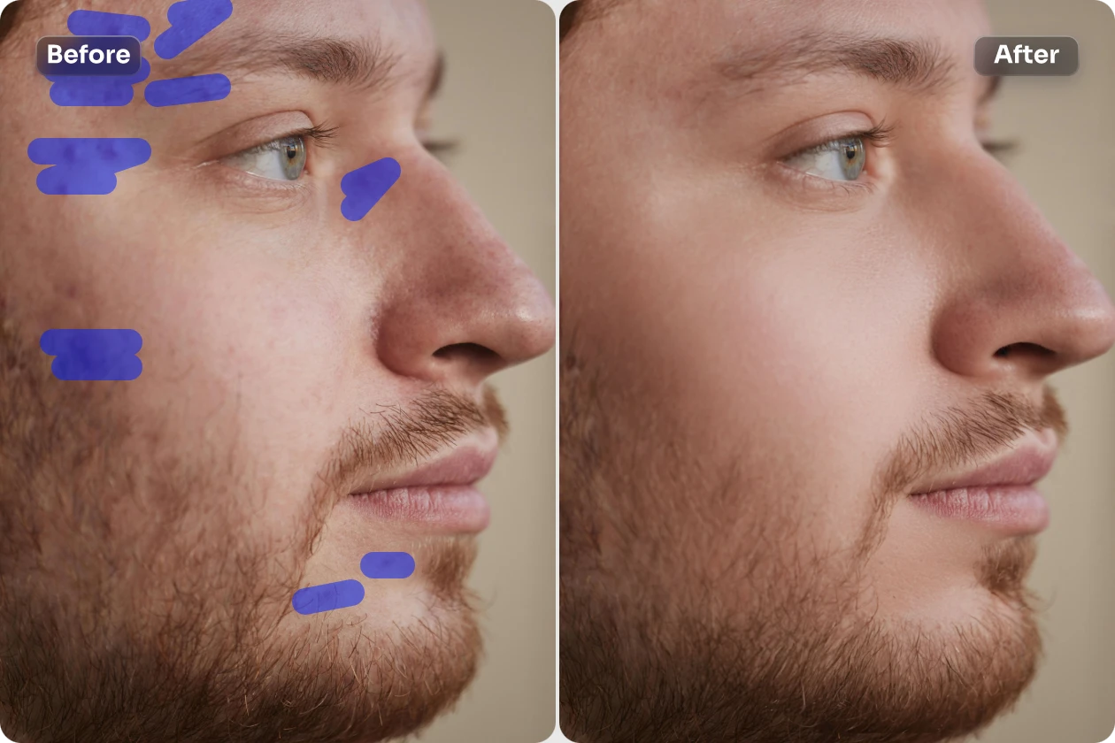 éliminez les taches du visage masculin en utilisant le mode manuel