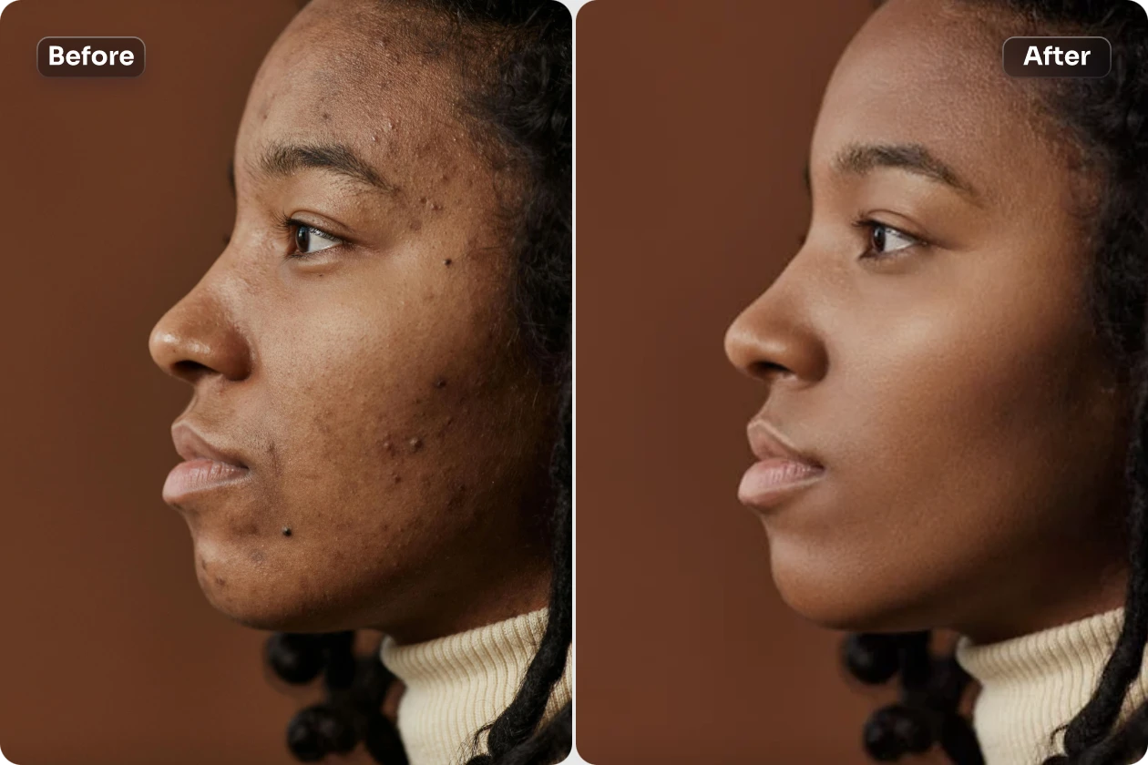 Lisser la peau du visage d'une femme en utilisant AI Ease, un logiciel gratuit de retouche de portrait en ligne.