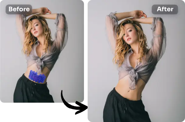 before and after effects of a tattoo being removed from the fashion female model's abdomen